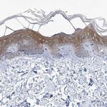 Desmoplakin 1 Antibody in Immunohistochemistry (IHC)