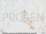 Cytokeratin 7 Antibody in Immunohistochemistry (IHC)