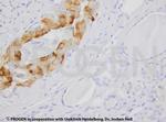 Cytokeratin 7 Antibody in Immunohistochemistry (IHC)