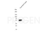 Cytokeratin 5/8 Antibody in Western Blot (WB)