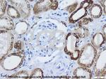 Cytokeratin 8 Antibody in Immunohistochemistry (IHC)
