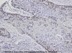 p53 Protein Antibody in Immunohistochemistry (IHC)