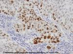 p53 Protein Antibody in Immunohistochemistry (IHC)