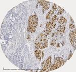 p53 Protein Antibody in Immunohistochemistry (IHC)