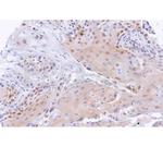 Cyclin D1 Antibody in Immunohistochemistry (Paraffin) (IHC (P))