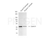 Cyclin D1 Antibody in Western Blot (WB)