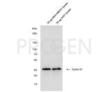 Cyclin D1 Antibody in Western Blot (WB)