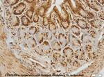Cytokeratin 20 Antibody in Immunohistochemistry (IHC)