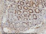 Cytokeratin 20 Antibody in Immunohistochemistry (IHC)