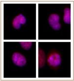 BMI-1 Antibody in Immunocytochemistry (ICC/IF)