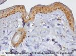 DSC1 Antibody in Immunohistochemistry (IHC)