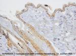 DSC1 Antibody in Immunohistochemistry (IHC)