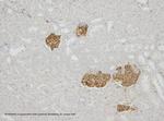 Synaptopodin Antibody in Immunohistochemistry (IHC)