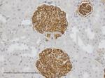 Synaptopodin Antibody in Immunohistochemistry (IHC)