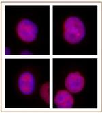 KLF5 Antibody in Immunocytochemistry (ICC/IF)