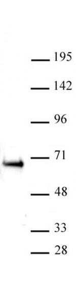 ETO / RUNX1T1 Antibody in Western Blot (WB)