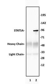 STAT5A Antibody in Immunoprecipitation (IP)