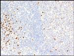 PIM2 Antibody in Immunohistochemistry (Paraffin) (IHC (P))