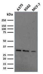 Replication Protein A2 (RPA2) Antibody in Western Blot (WB)