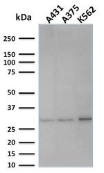 Replication Protein A2 (RPA2) Antibody in Western Blot (WB)