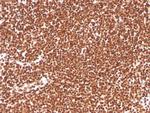 Replication Protein A2 (RPA2) Antibody in Immunohistochemistry (Paraffin) (IHC (P))