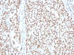Replication Protein A2 (RPA2) Antibody in Immunohistochemistry (Paraffin) (IHC (P))
