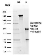 Replication Protein A2 (RPA2) Antibody in SDS-PAGE (SDS-PAGE)