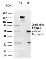 Replication Protein A2 (RPA2) Antibody in Immunoelectrophoresis (IE)