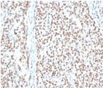 Replication Protein A2 (RPA2) Antibody in Immunohistochemistry (Paraffin) (IHC (P))