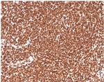 Replication Protein A2 (RPA2) Antibody in Immunohistochemistry (Paraffin) (IHC (P))