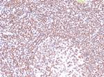 Replication Protein A2 (RPA2) Antibody in Immunohistochemistry (Paraffin) (IHC (P))