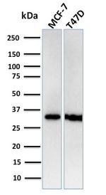 Replication Protein A2 (RPA2) Antibody in Western Blot (WB)