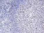 EED Antibody in Immunohistochemistry (Paraffin) (IHC (P))