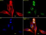 ASPM / MCPH5 Antibody in Immunocytochemistry (ICC/IF)