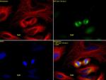 ASPM / MCPH5 Antibody in Immunocytochemistry (ICC/IF)