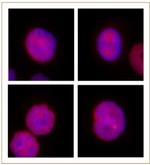 JMJD2B / KDM4B Antibody in Immunocytochemistry (ICC/IF)