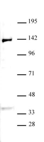 JMJD2B / KDM4B Antibody in Western Blot (WB)