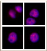 MOF / MYST1 Antibody in Immunocytochemistry (ICC/IF)