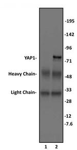 YAP1 Antibody in Immunoprecipitation (IP)
