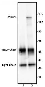 ATAD2 Antibody in Immunoprecipitation (IP)