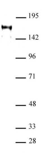 ATAD2 Antibody in Western Blot (WB)