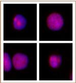 XRCC1 Antibody in Immunocytochemistry (ICC/IF)