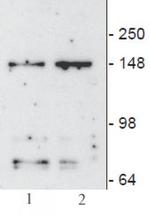 JMJD3 / KDM6B Antibody in Western Blot (WB)
