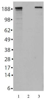 Tet2 Antibody in Western Blot (WB)
