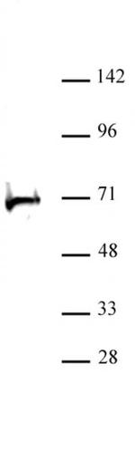 RBBP5 Antibody in Western Blot (WB)