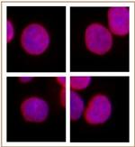 SMARCC1 / BAF155 Antibody in Immunocytochemistry (ICC/IF)