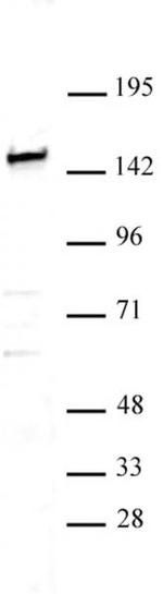 SMARCC1 / BAF155 Antibody in Western Blot (WB)