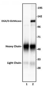 OGA/O-GlcNAcase Antibody in Immunoprecipitation (IP)