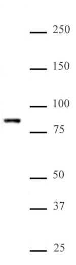 KMT2E (MLL5) Antibody in Western Blot (WB)