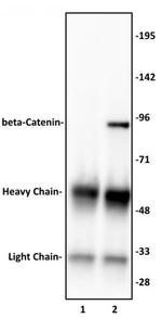 beta-Catenin Antibody in Immunoprecipitation (IP)